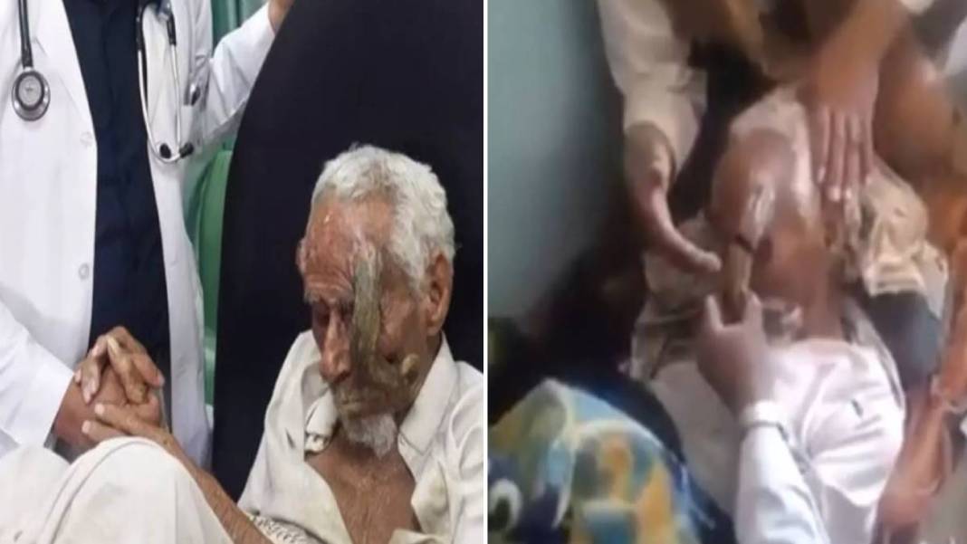 O yaştan boynuzları çıkmıştı! Boynuzlu dededen kahreden haber: Kimse gerçek olduğuna inanmamıştı ama... 3